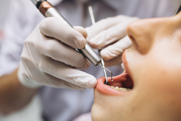 7 ferramentas de dentista que são essenciais para qualquer clínica odontológica